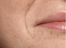 Морщины становятся глубже?